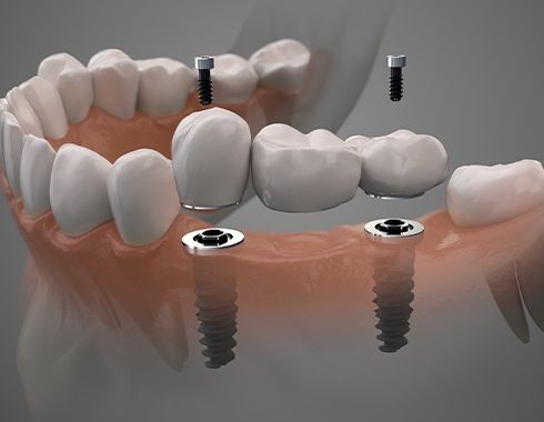 orthodontist avenel